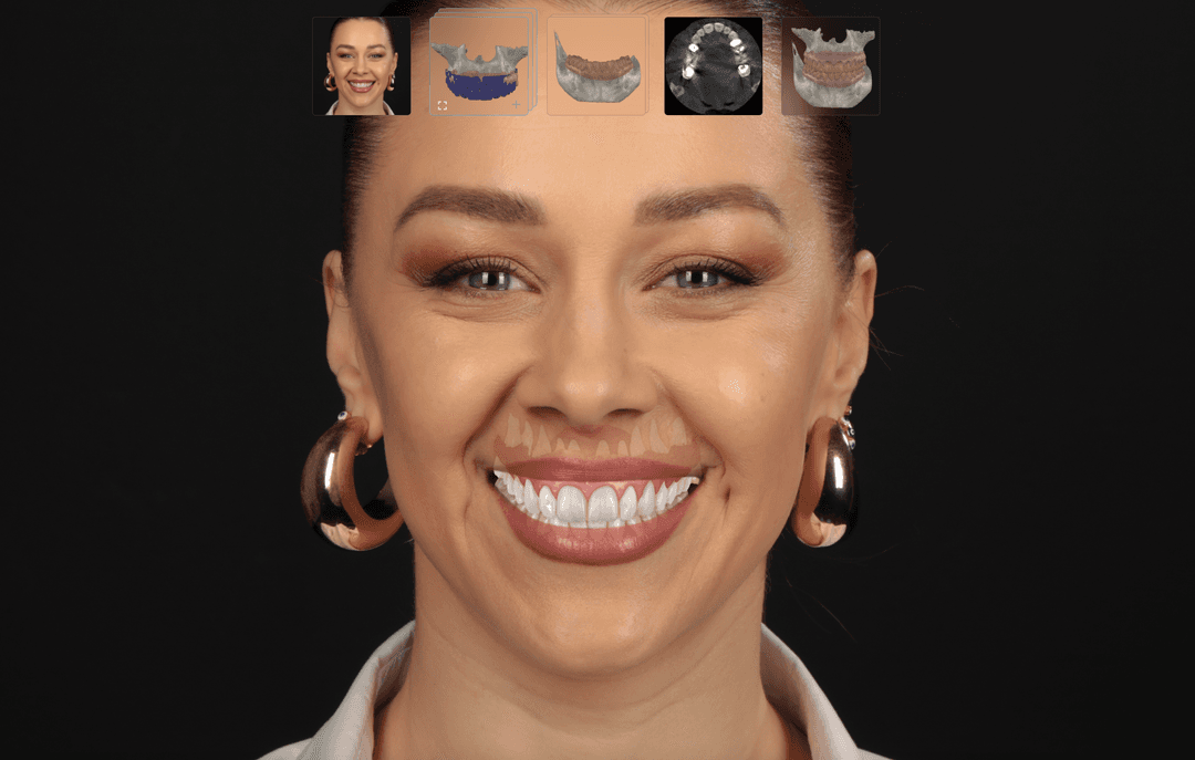 Treatment Planning Dentcof treatment-planning-dentcof